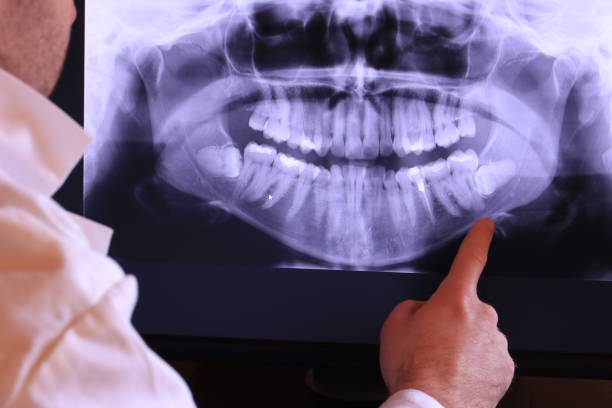 Best Knocked-Out Tooth Emergency  in Texanna, OK