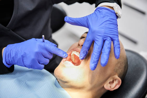 Best Teeth Whitening  in Texanna, OK