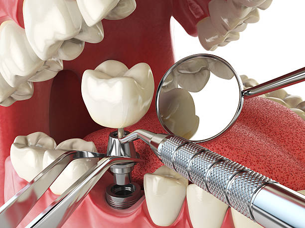 Best Urgent Tooth Repair  in Texanna, OK